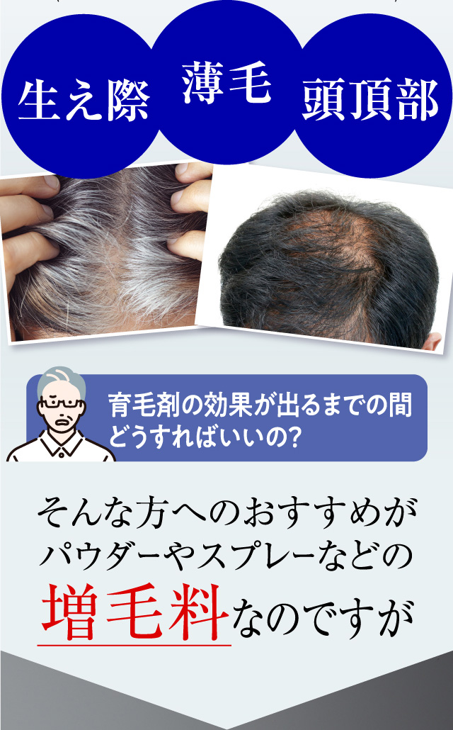 生え際・薄毛・頭頂部 育毛剤の効果が出るまでの間どうすればいいの？そんな方へのおすすめがパウダーやスプレーなどの増毛料なのですが